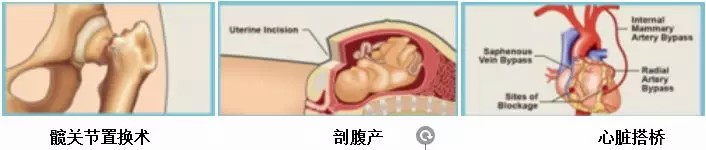 洁净服特性及测试的标准